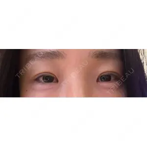 湘南美容クリニック 湘南美容クリニック 千葉センシティ院口コミ