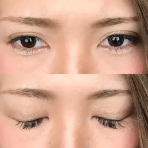 中央クリニック 大阪梅田中央クリニック美容外科口コミ