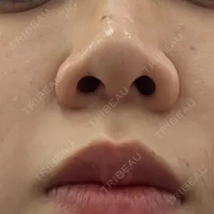 口コミ