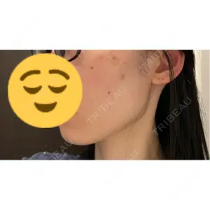 東京美容クリニックの口コミ
