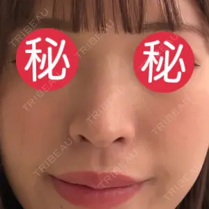 口コミ