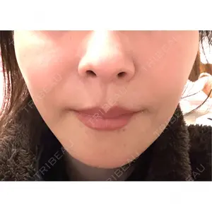 湘南美容クリニック 湘南美容クリニック 銀座院口コミ