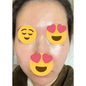 ミニマムスキンクリニック ミニマムスキンクリニック池袋口コミ