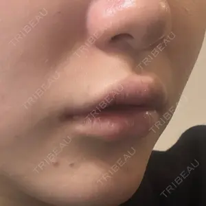 ルラ美容クリニック ルラ美容クリニック 大阪心斎橋院口コミ