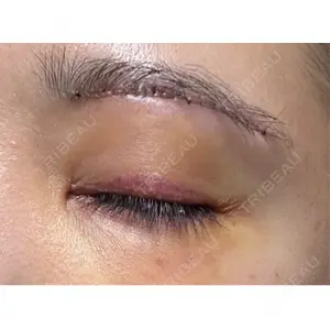 もとび美容外科クリニック 新宿院口コミ