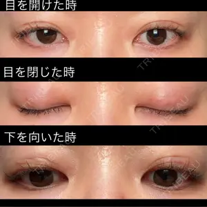 口コミ