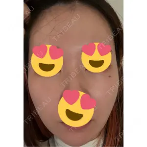 ミニマムスキンクリニック ミニマムスキンクリニック池袋口コミ