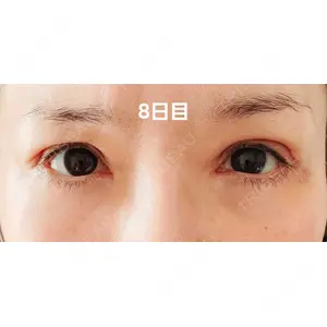 口コミ