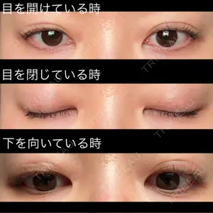 口コミ