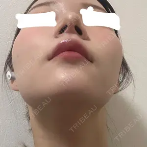 口コミ