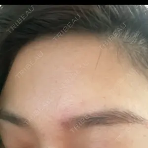 APスキンクリニック銀座口コミ