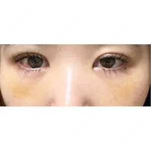 藤・ナチュレ美容クリニック 藤・ナチュレ美容クリニック 銀座院口コミ