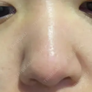 AYANAフィラーズクリニック AYANAフィラーズクリニック 渋谷院口コミ