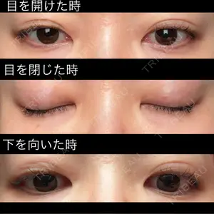 口コミ