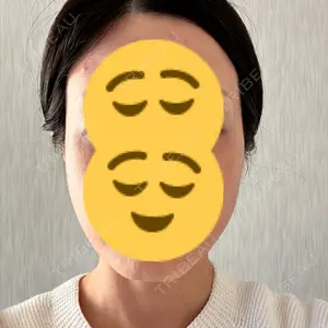 TCB東京中央美容外科 TCB東京中央美容外科 梅田茶屋町院口コミ