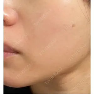 L‘amour clinic Tokyo【ラムールクリニック東京】口コミ