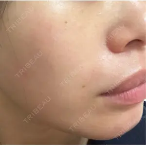 L‘amour clinic Tokyo【ラムールクリニック東京】口コミ