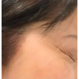 TCB東京中央美容外科 TCB東京中央美容外科 立川院口コミ