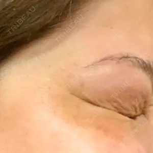 TCB東京中央美容外科 TCB東京中央美容外科 立川院口コミ