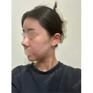 セギム美容整形外科口コミ