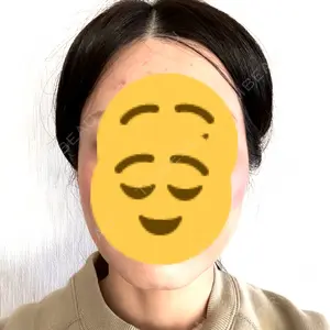 TCB東京中央美容外科 梅田茶屋町院口コミ