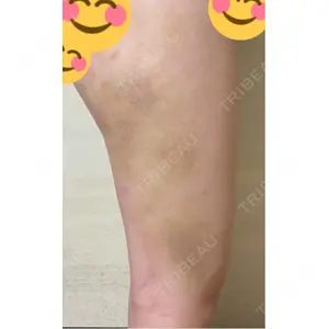 銀座マイアミ美容外科の