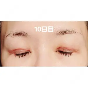 口コミ