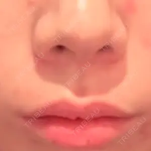 口コミ