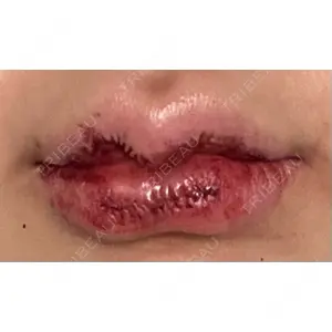 R Beauty CLINIC R Beauty CLINIC 銀座院口コミ