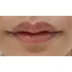 おおたかの森ビューティークリニック口コミ