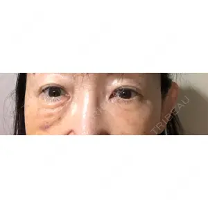 湘南美容クリニック 湘南美容クリニック 千葉センシティ院口コミ