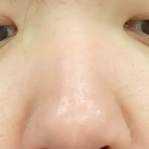 AYANAフィラーズクリニック AYANAフィラーズクリニック 渋谷院口コミ