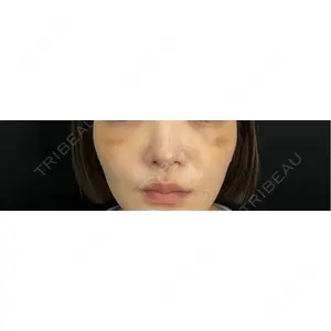 藤・ナチュレ美容クリニック 藤・ナチュレ美容クリニック 銀座院口コミ