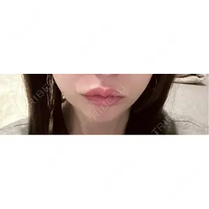 口コミ
