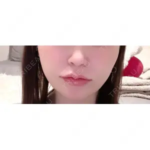 口コミ