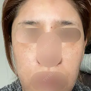 Kinshicho Beauty Clinic （錦糸町ビューティークリニック）口コミ