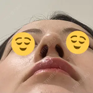 口コミ