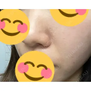 ミニマムスキンクリニック ミニマムスキンクリニック池袋口コミ