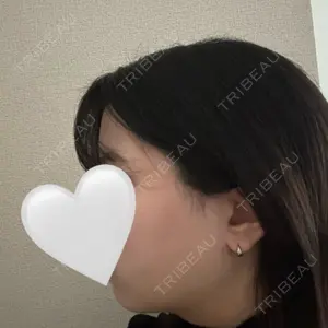東京シンデレラ美容外科 東京シンデレラ美容外科 池袋院口コミ