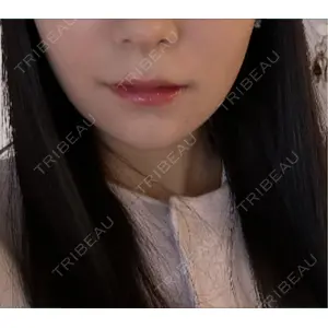 南青山スキンケアクリニック口コミ