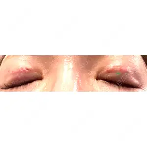 東京イセアクリニック口コミ
