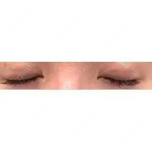 東京イセアクリニック口コミ