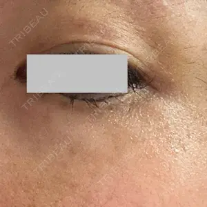 TCB東京中央美容外科 TCB東京中央美容外科 船橋院口コミ