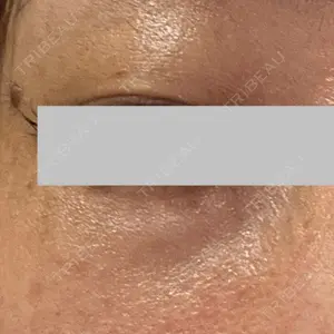 TCB東京中央美容外科 TCB東京中央美容外科 船橋院口コミ