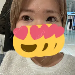 TCB東京中央美容外科 福岡博多院口コミ