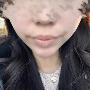 口コミ
