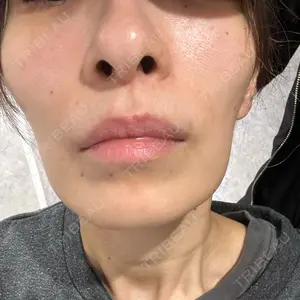 HELLATH CLINIC 新宿院口コミ