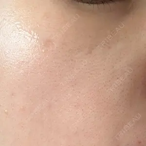 アスク美容クリニック銀座口コミ