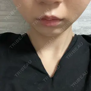 口コミ