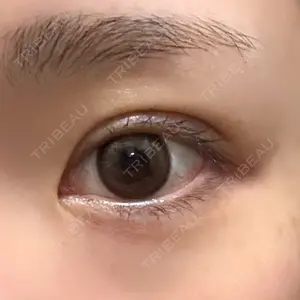 湘南美容クリニック 湘南美容クリニック 新宿本院口コミ